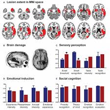 Brain structural correlates of executive